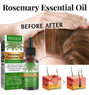 2×1 en Rosemary Essential Oil – ¡Segundo frasco GRATIS!🎇